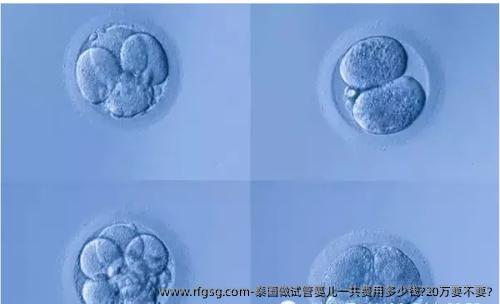 泰國(guó)做試管嬰兒一共費(fèi)用多少錢?20萬(wàn)要不要?