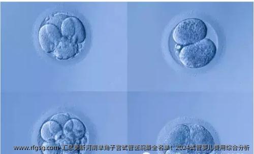 匯總更新河南單角子宮試管醫(yī)院最全名單！2024試管嬰兒費用綜合分析