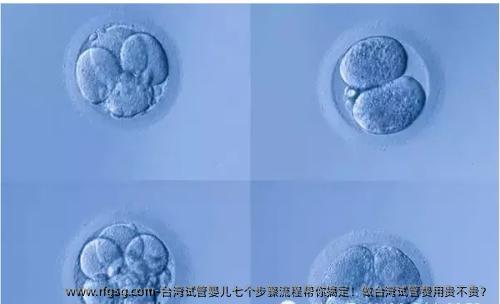 臺(tái)灣試管嬰兒七個(gè)步驟流程幫你搞定！做臺(tái)灣試管費(fèi)用貴不貴？