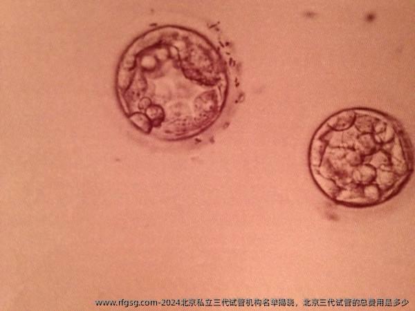2024北京私立三代試管機(jī)構(gòu)名單揭曉，北京三代試管的總費(fèi)用是多少