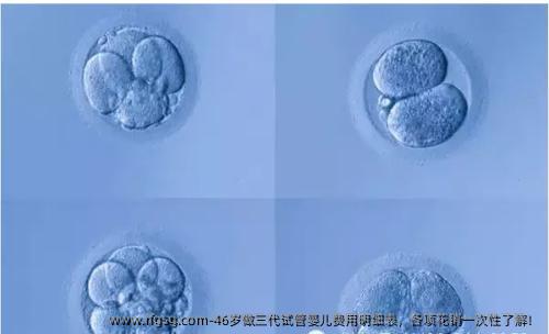 46歲做三代試管嬰兒費(fèi)用明細(xì)表，各項(xiàng)花銷一次性了解！