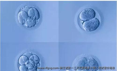 鎮(zhèn)江試管一二三代費(fèi)用多少錢？附試管價(jià)格表