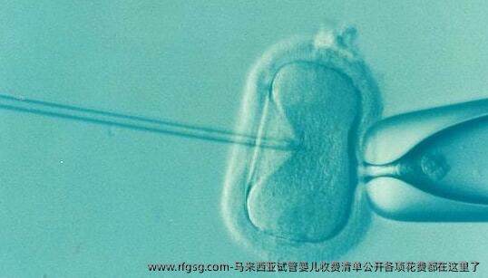 馬來西亞試管嬰兒收費清單公開各項花費都在這里了