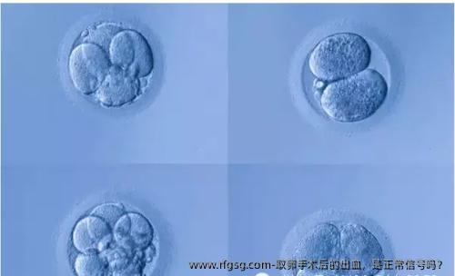 取卵手術(shù)后的出血，是正常信號嗎？