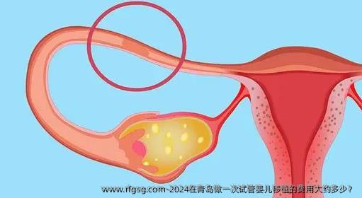 2024在青島做一次試管嬰兒移植的費(fèi)用大約多少？