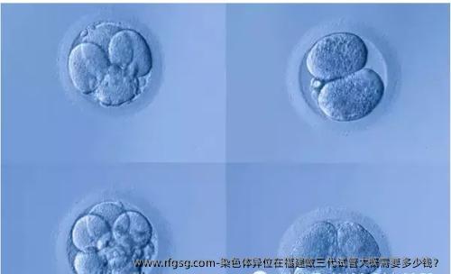 染色體異位在福建做三代試管大概需要多少錢？