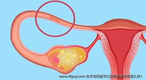 女方有問(wèn)題可以到邯鄲做試管嬰兒?jiǎn)幔?>
										</a>
									</div>
									<div   id=