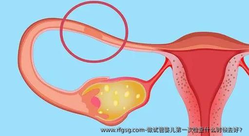 做試管嬰兒第一次檢查什么時候去好？