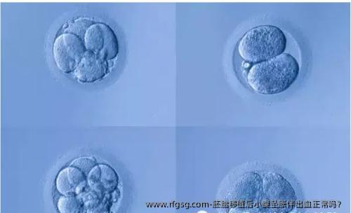 胚胎移植后小腹墜脹伴出血正常嗎？