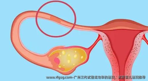 廣州三代試管成功率的醫(yī)院，試管嬰兒醫(yī)院推薦