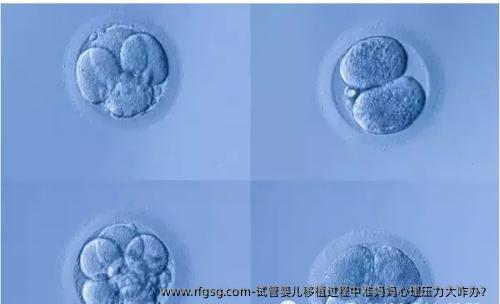 試管嬰兒移植過程中準(zhǔn)媽媽心理壓力大咋辦？