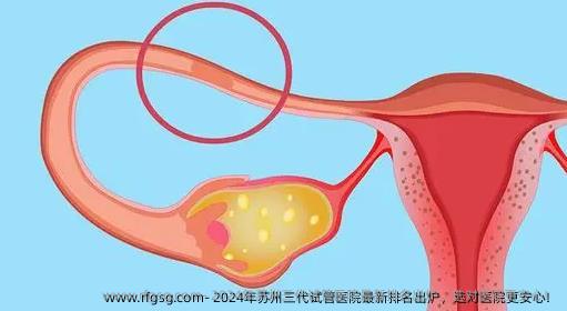 2024年蘇州三代試管醫(yī)院最新排名出爐，選對(duì)醫(yī)院更安心！