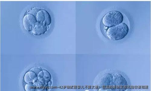 42歲做試管嬰兒不算太晚！但高齡妊娠這些風(fēng)險你要知道