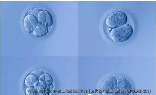 第三代試管技術(shù)有什么優(yōu)勢？第三代試管孕育零缺陷嬰兒！