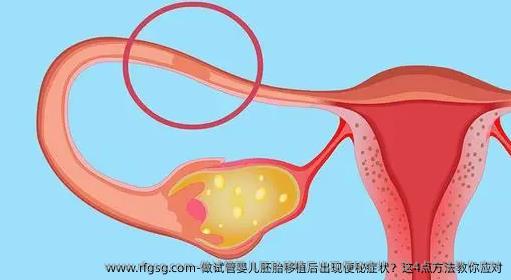 做試管嬰兒胚胎移植后出現(xiàn)便秘癥狀？這4點方法教你應對